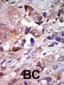 ZPK Antibody (C-term)
